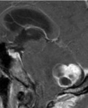 Prof. Dr. med. Merlo Adrian Bild 7