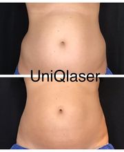 UniQ Laser Center Watertown image 9