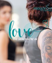 ENDLICH OHNE Tattooentfernung Filiale Brilon Bild 6