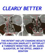 Sinus & Snoring Specialists image 15
