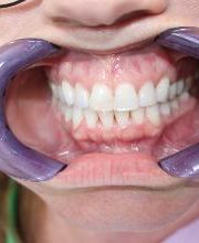 Hamilton Family Dentistry image 20