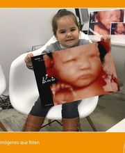 Ecox Dos Hermanas, Sevilla  Especialistas en ecografías 5D, 4D y 8K imagen 9