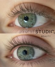 Wimpernkranzverdichtung