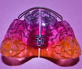 Dental Design ILG Bild 3