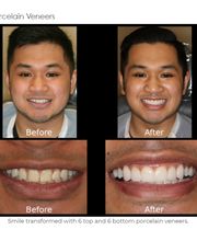 The Dental Design Center - Cosmetic, Implant & General Dentistry image 3