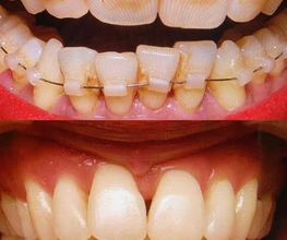 ORTHOLIGHT Orthodontie Bild 7