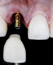 Clinique Dentaire de Meyrin Bild 10