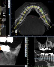 Providence Dental Spa | East Cobb image 8