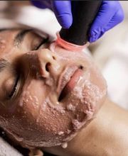 Endermospa image 1