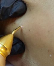 ALPINE SKIN CLINIC / Dr ZD CLINIC Bild 3