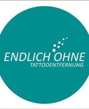 ENDLICH OHNE Tattooentfernung Filiale Landshut Bild 2