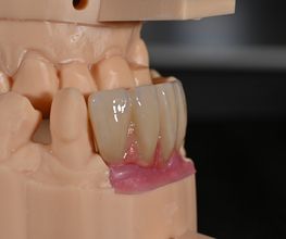 ModeLab Dental Bild 14