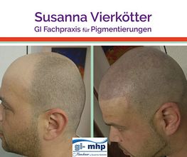 Haarpigmentierung Gi mhp -