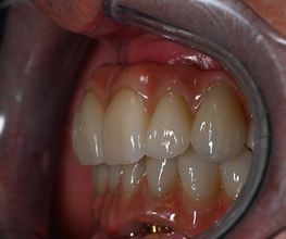 ModeLab Dental Bild 9