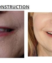 Aspen Ridge Dental image 5