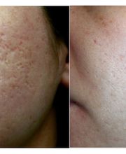 Studio di Medicina Estetica Dr. Med. Monique Wortelboer Bild 9