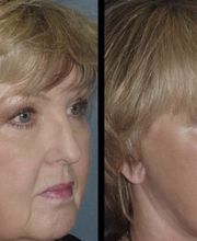 Agata Brys, MD Facial Plastic Surgery image 3