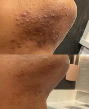 Pure Lux Medspa image 11