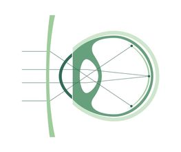 Ottica Martini Sagl Bild 2