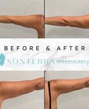 Sonterra Dermatology image 3