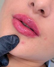 Estética Raphaela Santana imagen 8
