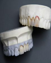 LB PROTHESES DENTAIRES image 1