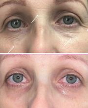 Wrinkle Free WA image 6