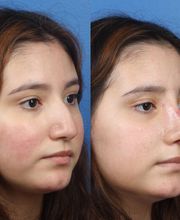 Gotham Plastic Surgery image 4