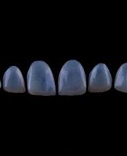 Lente de Contato Dental, Dr. Marcelo Borille imagen 3