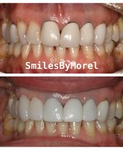 Smiles By Morel image 1