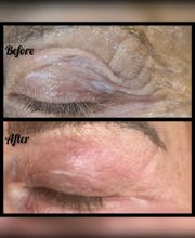 Wrinkle Free WA image 19