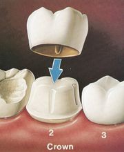 Bandy Dental image 13