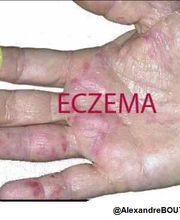 Boutouchent Abdelaziz Alexandre image 1