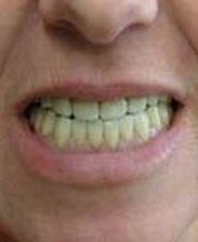 Clínica Implanteoral Milladoiro imagen 12