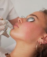 Dauerhafte Haarentfernung - Remove Laserzentrum Stuttgart Bild 7