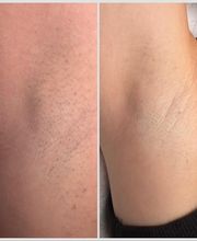 Nicoleta EpiArt Schönheitssalon Bild 3