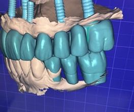 DentalLook Sagl Bild 7