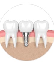 Philip M Robitaille, D.D.S. & Associates image 11