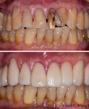 Providence Dental Spa | East Cobb image 18