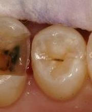 TERAN Dental Co. image 15