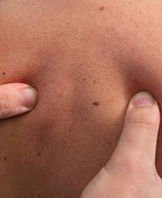 Casse Nicolas image 2