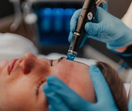 Hydrafacial-Behandlung Mann im Kosmetikstudio von Margarita M. Cosmetics in Remscheid
