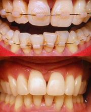 ORTHOLIGHT Orthodontie Bild 7