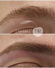 DERM UP image 6