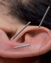 nayandei Akupunktur & Chinesische Medizin Bild 2