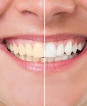 First Smiles Dental and Braces image 5
