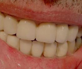 Clínica Dental Quart imagen 8