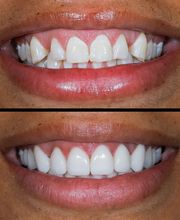 Flawless Smile Dentistry Claremore image 5