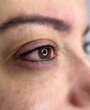 Micropigmentación para tí imagen 9