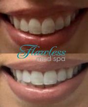 Flawless Med Spa image 1